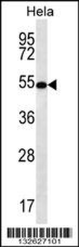 SCHIP1 Antibody (Center)