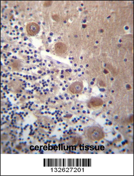SCHIP1 Antibody (Center)