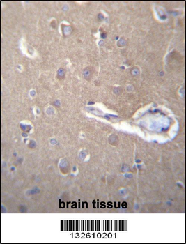SEC62 Antibody (N-term)