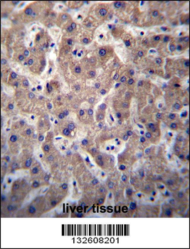 SULT1A3/SULT1A4 Antibody (N-term)