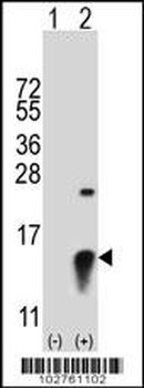 SUMO2 Antibody (C-term)
