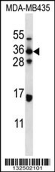 ELOVL5 Antibody (C-term)