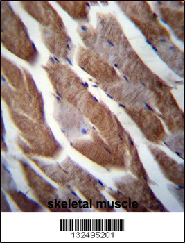 MATN1 Antibody (C-term)