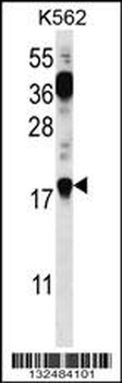 PTMS Antibody (C-term)