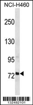 RFX2 Antibody (C-term)