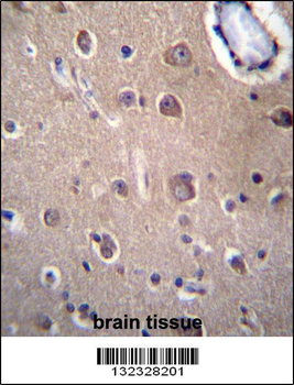 SLC8A3 Antibody (C-term)