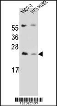 LIN7C Antibody (C-term)