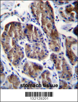 RPS4Y1 Antibody (Center)