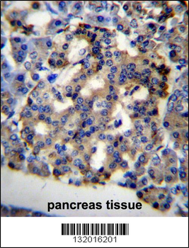 TWNK Antibody (C-term)