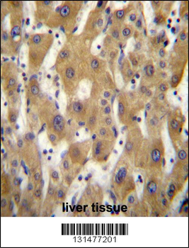PAGE5 Antibody (C-term)