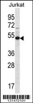 FA8A1 Antibody (N-term)