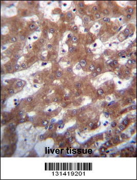 TRUB1 Antibody (Center)