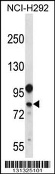 DDX3Y Antibody (N-term)
