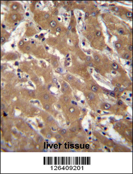 SPOPL Antibody (Center)