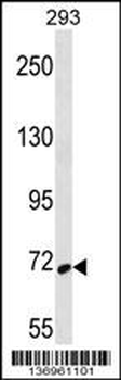 SYK Antibody