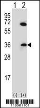 CDCA8 Antibody (N-term)
