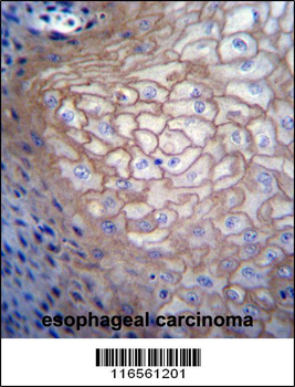 CDCA8 Antibody (N-term)