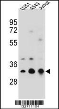 TPM4 Antibody (N-term)