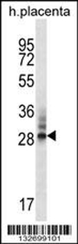 DNAJC27 Antibody (N-term)