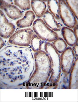 DNAJC27 Antibody (N-term)