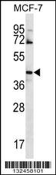GNA14 Antibody (N-term)