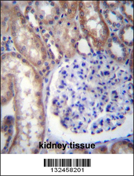 GNA14 Antibody (N-term)