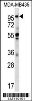 CTAGE5 Antibody (C-term)