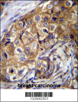 CTAGE5 Antibody (C-term)