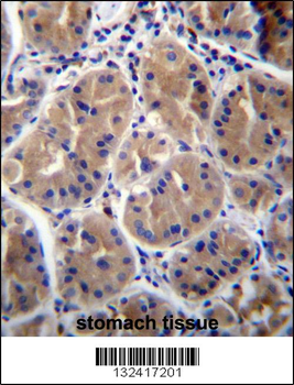 RAB27B Antibody (Center)