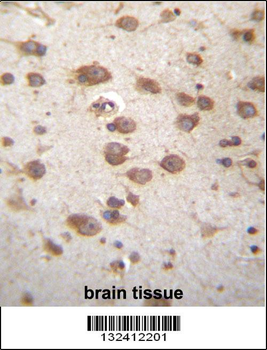 STAP2 Antibody (Center)