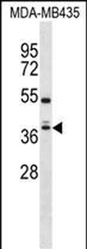 SLC30A7 Antibody (N-term)