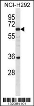 BTBDG Antibody (N-term)