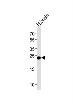 GSTM5 Antibody (N-term)