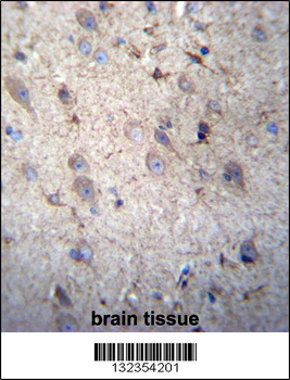 GSTM5 Antibody (N-term)