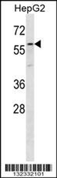 ZP4 Antibody (C-term)