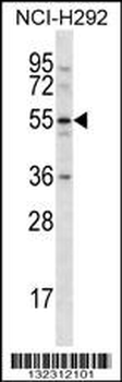CLEC18A Antibody (C-term)