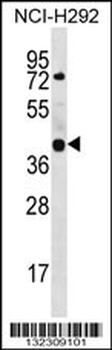 GTPBP10 Antibody (C-term)