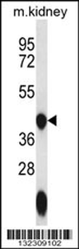 GTPBP10 Antibody (C-term)