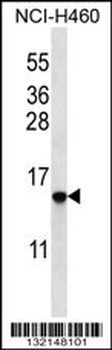 HIST1H2BO/HIST1H2BH Antibody (N-term)