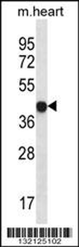 LPAR6 Antibody (Center)