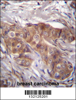 LPAR6 Antibody (Center)