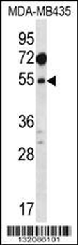 MAT1A Antibody (N-term)