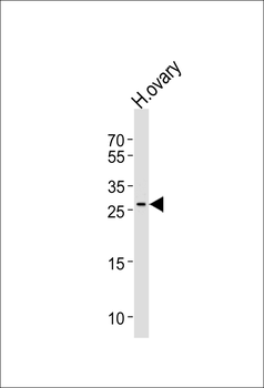 LRRN4CL Antibody (Center)