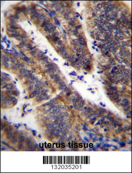LRRN4CL Antibody (Center)