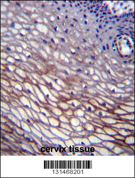 SKA2 Antibody (N-term)