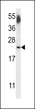CNRP1 Antibody (Center)