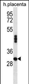 EFCAB4A Antibody (N-term)