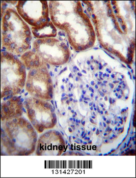 CB044 Antibody (N-term)