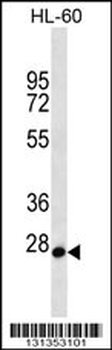 MED22 Antibody (N-term)