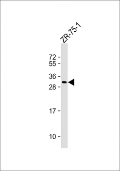 CSN2 Antibody (N-term)